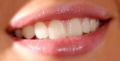 The Laser Teeth Whitening system practiced at Harley Street Whitening Clinic utilises the most advanced and innovative technology and materials to whiten your teeth safely, quickly and effectively. Our expert team will ensure your teeth get whiter faster and stay whiter longer with our supremely effective system. To ensure your safety and comfort, the treatment will normally be completed within one visit, minimising your risk of experiencing tooth sensitivity. We guarantee at least 5 shades of lightening (measured on the Vita Shade Whitening Chart). A complimentary follow up appointment will be scheduled if your first treatment does not result in this level of whitening. All treatments are carried out by a GDC (General Dental Council) registered cosmetic dentist. You will enjoy: Choice of one Laser Whitening Treatment (60 Minutes), from the selection: Laser Whitening in Clinic with GDC Dentist Incl. Consultation OR Laser Whitening in Clinic with GDC Dentist Incl. Consultation and Home Care System