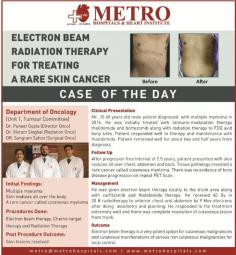 #CompleteCancerCare

#DrPuneetGupta team cured "Electron Beam Radiation Therapy for Treating a Rare Skin Cancer".
https://bit.ly/2ReprOg
http://bit.ly/2TXkc7h