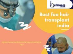 We offer best fue hair transplant india ,In Jaipur you get surgical procedures for hair restoration treating every individual hair using this service.
For more info visit us : https://www.outbloomclinics.com/what-is-fue/