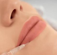 Achieving fuller, balanced lips requires precision, artistry, and an understanding of facial harmony. Lip enhancement treatments are designed to improve shape, volume, and definition while maintaining a natural appearance. Patients often seek subtle improvements that complement their existing features rather than dramatic changes. During treatment planning, Lip Filler Upper East Side services focus on personalized results that suit each individual’s anatomy and aesthetic goals. Modern dermal fillers provide smooth, predictable outcomes with minimal downtime. Whether enhancing lip contours or restoring lost volume, these treatments can create a refreshed, youthful appearance that boosts confidence and complements overall facial aesthetics.