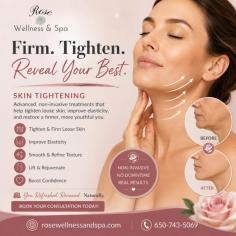 Looking for effective skin tightening treatment in San Mateo? Rose Wellness & Spa offers advanced, non-invasive treatments designed to improve skin elasticity, reduce sagging, and restore a firmer, more youthful appearance. By stimulating natural collagen production, our customized procedures help tighten loose skin on the face, neck, and body while improving overall texture and tone. Whether you're concerned about signs of aging or simply want a refreshed look, our experienced professionals provide tailored treatments to help you achieve smoother, healthier-looking skin.