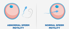 Planning for a family begins with understanding your reproductive health and choosing reliable diagnostic services. Professional fertility testing provides valuable information that helps individuals make informed healthcare decisions. Selecting a trusted provider ensures accurate results, privacy, and a comfortable testing experience.Male Fertility Test Austin TX is an important search term for individuals seeking dependable fertility evaluation from experienced laboratories and healthcare professionals. A comprehensive male fertility assessment measures sperm count, motility, morphology, and other essential factors that contribute to reproductive health. Early testing can help identify potential concerns and support timely medical guidance when needed.