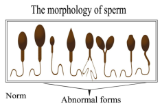 Male fertility testing is an important part of understanding reproductive health and making informed decisions about family planning. A professional sperm test provides valuable insights into sperm quality, including count, movement, shape, and overall semen health.Choosing a trusted testing provider ensures accurate results, confidentiality, and a smooth experience.Sperm Test Houston helps individuals access reliable fertility testing services that support better awareness of reproductive wellness and informed healthcare planning.Hera Fertility helps individuals find dependable fertility testing laboratories in the Houston area that follow professional standards and provide accurate diagnostic services. Sperm testing can offer important information about reproductive health and help healthcare providers understand potential fertility concerns. Reliable laboratory reports allow individuals to discuss results confidently and explore suitable options based on their needs.