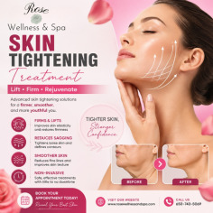 Looking for a non-invasive skin tightening treatment in San Mateo? Rose Wellness & Spa offers personalized treatments designed to help improve the appearance of loose or sagging skin and promote a smoother, firmer-looking complexion. Whether you’re looking to enhance your facial contours or improve the appearance of targeted body areas, our wellness-focused approach can help you feel more confident in your skin. Discover your options with Rose Wellness & Spa.
